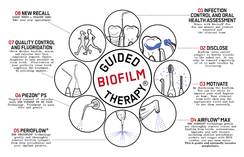  Guided Biofilm Therapy Certified Practice