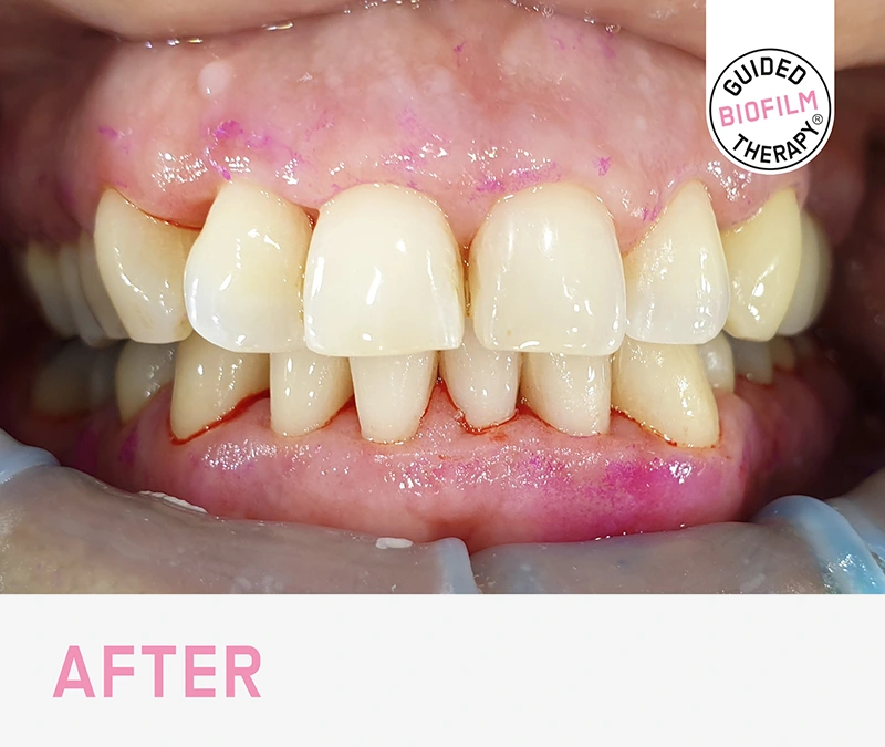  Guided Biofilm Therapy Certified Practice